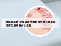 疑似银屑病 疑似银屑病病检报告是符合皮炎湿疹类病证是什么意思