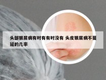 头部银屑病有时有有时没有 头皮银屑病不蔓延的几率