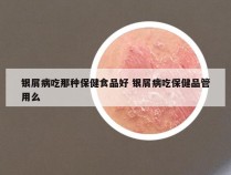银屑病吃那种保健食品好 银屑病吃保健品管用么