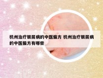 杭州治疗银屑病的中医偏方 杭州治疗银屑病的中医偏方有哪些