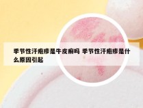 季节性汗疱疹是牛皮癣吗 季节性汗疱疹是什么原因引起