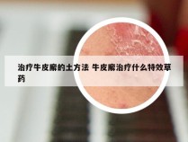 治疗牛皮廨的土方法 牛皮廨治疗什么特效草药