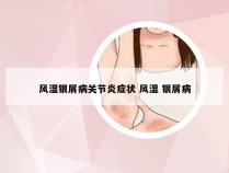 风湿银屑病关节炎症状 风湿 银屑病
