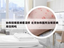 协和挂银屑病看湿疹 北京协和医院治银屑病用住院吗