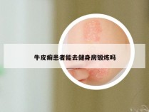 牛皮癣患者能去健身房锻炼吗
