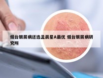 烟台银屑病还选孟晨星A最优 烟台银屑病研究所