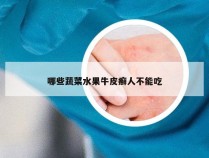 哪些蔬菜水果牛皮癣人不能吃