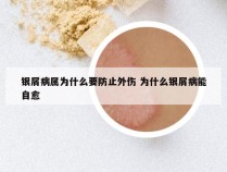 银屑病属为什么要防止外伤 为什么银屑病能自愈