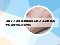 成都公立银屑病医院哪家治的好 成都银屑病专科医院是私立医院吗