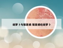 胡萝卜与银屑病 银屑病吃胡萝卜