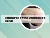成都银屑病专科医院咨询 成都银屑病医院真的能医吗