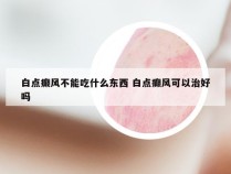 白点癫风不能吃什么东西 白点癫风可以治好吗