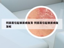 何因易引起银屑病复发 何因易引起银屑病复发呢