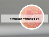 牛皮癣药膏乙 牛皮癣药膏多少钱