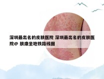 深圳最出名的皮肤医院 深圳最出名的皮肤医院@ 肤康坐地铁路线图