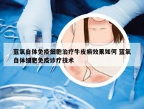 蓝氧自体免疫细胞治疗牛皮癣效果如何 蓝氧自体细胞免疫诊疗技术