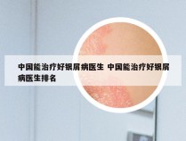 中国能治疗好银屑病医生 中国能治疗好银屑病医生排名
