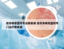 南京哪家医院专治银屑病 南京有哪家医院专门治疗银屑病