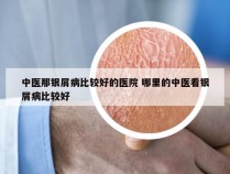 中医那银屑病比较好的医院 哪里的中医看银屑病比较好