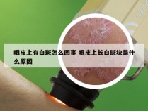 眼皮上有白斑怎么回事 眼皮上长白斑块是什么原因