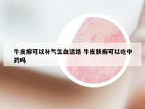 牛皮癣可以补气生血活络 牛皮肤癣可以吃中药吗