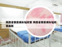 陕西省银屑病补贴政策 陕西省银屑病补贴政策最新