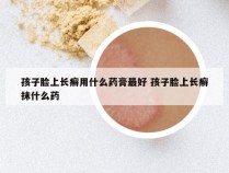 孩子脸上长癣用什么药膏最好 孩子脸上长癣抹什么药