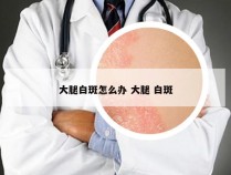 大腿白斑怎么办 大腿 白斑