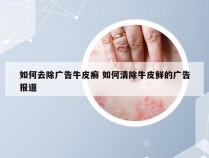 如何去除广告牛皮癣 如何清除牛皮鲜的广告报道