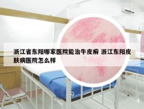 浙江省东阳哪家医院能治牛皮癣 浙江东阳皮肤病医院怎么样