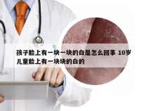 孩子脸上有一块一块的白是怎么回事 10岁儿童脸上有一块块的白的