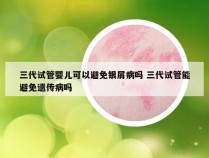 三代试管婴儿可以避免银屑病吗 三代试管能避免遗传病吗