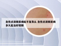 急性点滴银屑病能不复发么 急性点滴银屑病多久能治好初期