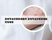 昆明专业的银屑病医院 昆明专业的银屑病医院有哪些