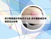 孩子银屑病父母难受怎么办 孩子银屑病父母难受怎么办呢