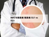 MHC与银屑病 银屑病 il17 vs il23