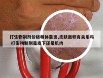 打生物制剂价格和体重面,皮肤面积有关系吗 打生物制剂是皮下还是肌肉