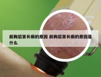 前胸后背长癣的原因 前胸后背长癣的原因是什么