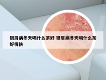 银屑病冬天喝什么茶好 银屑病冬天喝什么茶好得快
