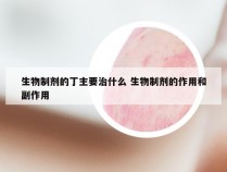 生物制剂的丁主要治什么 生物制剂的作用和副作用