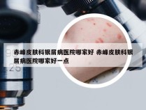 赤峰皮肤科银屑病医院哪家好 赤峰皮肤科银屑病医院哪家好一点