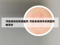 河南南阳皮肤病医院 河南省南阳市皮肤医院哪家好