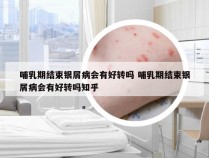 哺乳期结束银屑病会有好转吗 哺乳期结束银屑病会有好转吗知乎