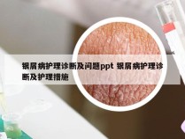 银屑病护理诊断及问题ppt 银屑病护理诊断及护理措施