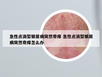 急性点滴型银屑病突然奇痒 急性点滴型银屑病突然奇痒怎么办