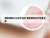 银屑病用什么光疗仪好 银屑病用光疗效果怎样