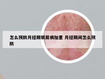 怎么预防月经期银屑病加重 月经期间怎么预防
