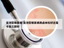 龙泡型银屑病 龙泡型银屑病用卤米松好还是卡伯三醇好