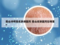 眉山诗碑路皮肤病医院 眉山皮肤医院在哪里?
