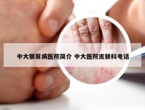 中大银屑病医院简介 中大医院皮肤科电话